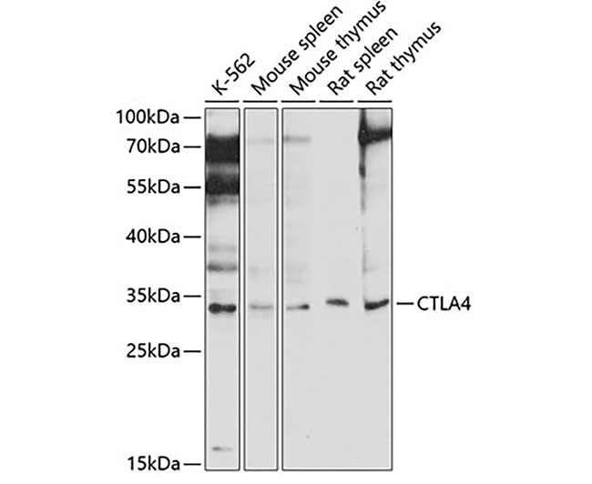 CTLA4 Rabbit Polyclonal Antibo
