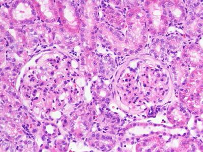 绵羊抗大鼠肾小球基底膜血清 Sheep Anti-Rat A