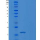 人CD79B/B29重组蛋白C-6His