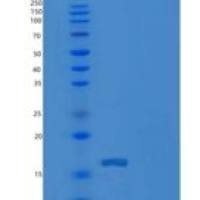 人CD79B/B29重组蛋白C-6His