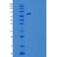 小鼠肝配蛋白A受体3(EPHA3)重组蛋白His tag