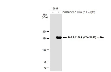 SARS-CoV-2 (COVID-19) Spike an