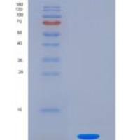 小鼠趋化因子配体2(CXCL2)重组蛋白
