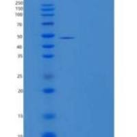 人谷氨酸草酰乙酸转氨酶1（GOT1）重组蛋白C-6His