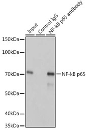 NFkB p65 antibody [GT1185]
