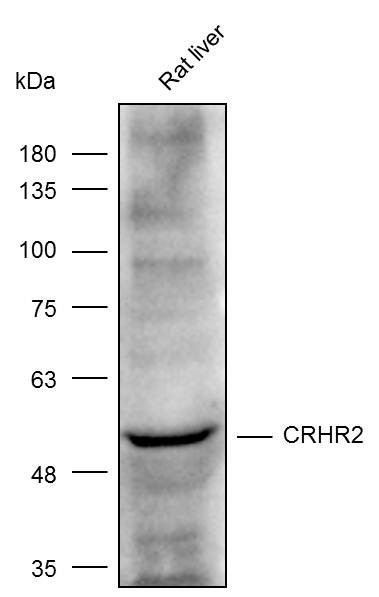 Anti-CRHR2 Polyclonal Antibody