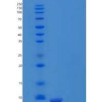 人C-X-C基序趋化因子12/CXC l12/SDF-1(22-93)重组蛋白