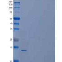 人细胞色素b5 B/CYB5B重组蛋白C-6His