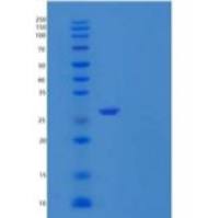 人白介素20受体α(IL20Ra)重组蛋白C-6His