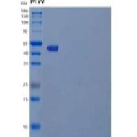 人微管蛋白β-4A链/微管B4A重组蛋白N-6His