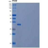 人胰岛素样生长因子结合蛋白5(IGFBP5)重组蛋白C-6His