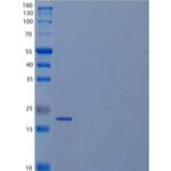 人周期素依赖性激酶抑制因子1B(CDKN1B)重组蛋白N-6His