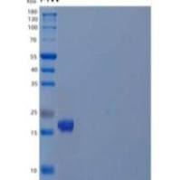 人肽基脯氨酰顺反异构酶样1重组蛋白