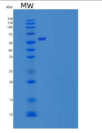人PACSIN2/Syndapin-2重组蛋白C-6His
