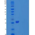 小鼠白细胞介素1受体拮抗蛋白/白细胞介素1ra/白细胞介素1RA重组蛋白