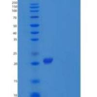 小鼠白细胞介素1受体拮抗蛋白/白细胞介素1ra/白细胞介素1RA重组蛋白