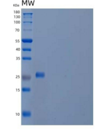 人顶体蛋白SP-10/ACRV1重组蛋白C-6His