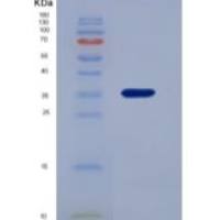 人唾液富组蛋白3(HTN3)重组蛋白