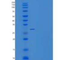 人PAF-AH亚单位β/PAFAHB重组蛋白C-6His