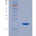 小鼠白介素22(IL22)重组蛋白