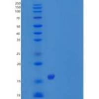 人OX40 Ligand/TNFSF4/OX40L重组蛋白N-6His