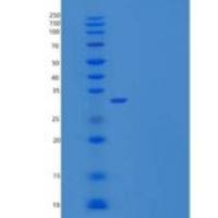 人促肾上腺皮质素释放激素结合蛋白(CRHBP)重组蛋白C-6His