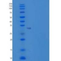 人核转录因子Y亚单位α/NFYA重组蛋白