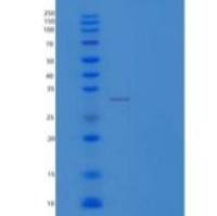 人氯离子细胞内通道蛋白5/CLIC5重组蛋白N-6His