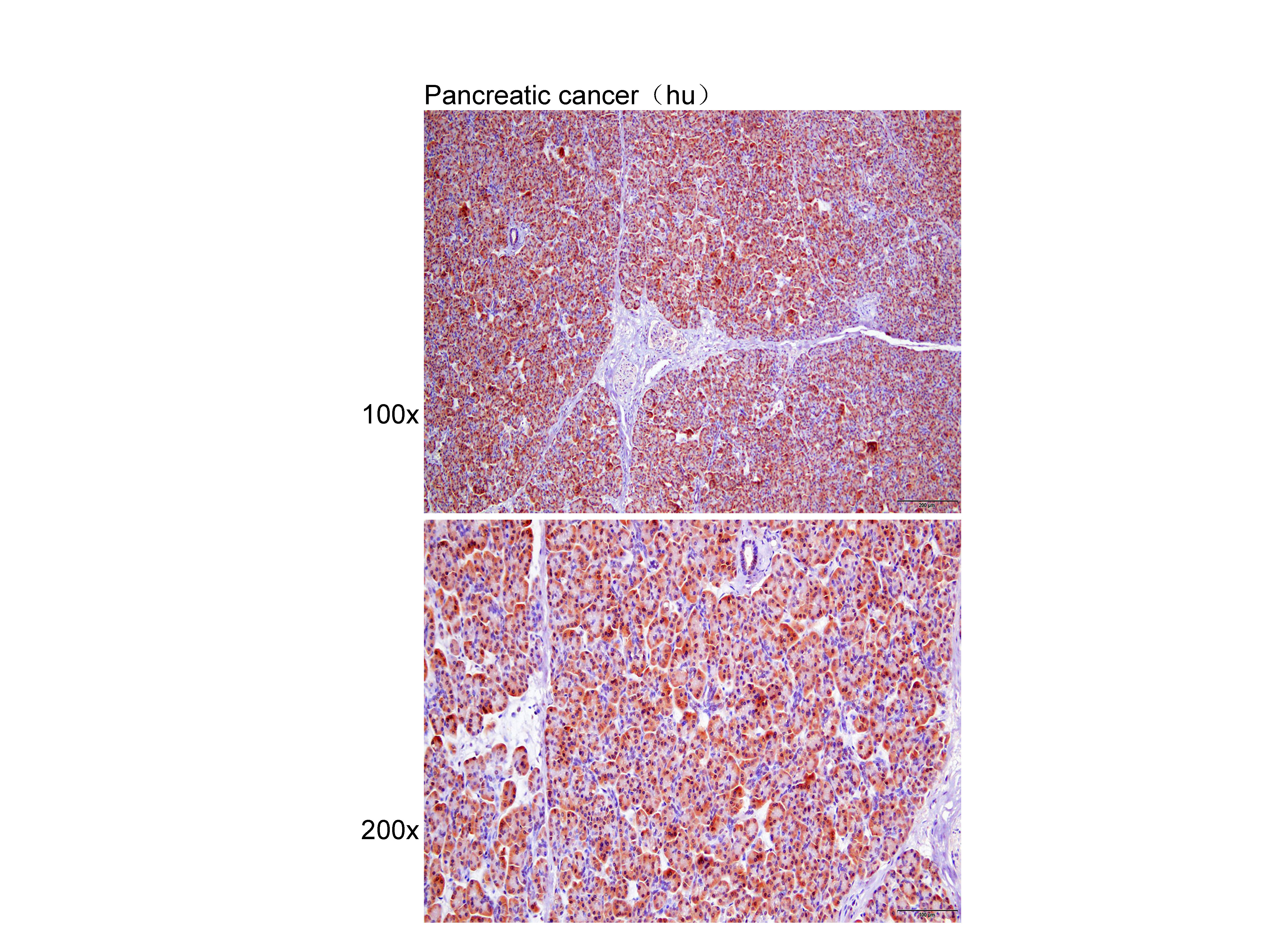 Anti-hCG beta Polyclonal Antib