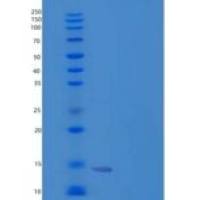 人癌调蛋白(OCM)重组蛋白