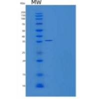 人反式-2-烯酰辅酶a还原酶线粒体/MECR重组蛋白C-6His