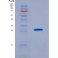 人甲状旁腺激素相关蛋白质/甲状旁腺激素重组蛋白C-6His