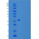 人Toll相互作用蛋白(TOLLIP)重组蛋白C-6His