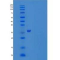 人Toll相互作用蛋白(TOLLIP)重组蛋白C-6His
