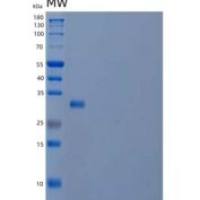 人EGF样域半胱氨酸丰富蛋白2(CRELD2)重组蛋白C-6His