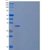 人含三联基序的蛋白质5/TRIM5/RNF88重组蛋白N-6His