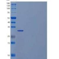 人含三联基序的蛋白质5/TRIM5/RNF88重组蛋白N-6His