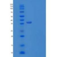 大鼠白介素12(IL12)重组蛋白