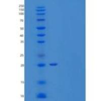 人转录抑制蛋白YY1重组蛋白C-6His