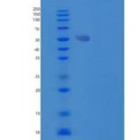 小鼠磷脂酰肌醇蛋白聚糖1(GPC1)重组蛋白C-6His