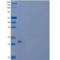 人U6 snRNA相关Sm样蛋白LSm4/LSM4重组蛋白N-6His