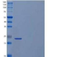 人细胞周期蛋白依赖激酶抑制剂1/CDKN1A/p21重组蛋白C-6His