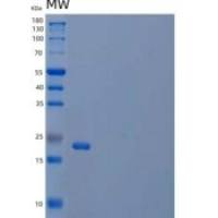 人肽基-脯氨酰顺反异构酶FKBP7/FKBP7重组蛋白C-6His