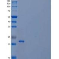 人肽基-脯氨酰顺反异构酶H（PPIH）重组蛋白