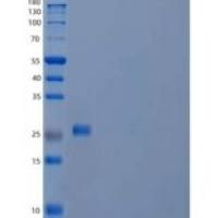 人顶体蛋白SP-10/ACRV1重组蛋白C-6His