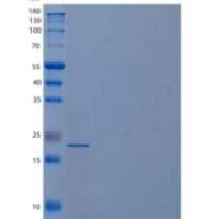 人肿瘤坏死因子α/TNFα重组蛋白N-6His