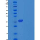 人IL-2受体亚单位β/IL-2RB/CD122重组蛋白C-6His