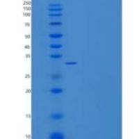 人C-X3-C基序趋化因子1/CX3CL1/Fractalkine重组蛋白C-6His