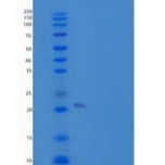 人TMX2/TXNDC14重组蛋白N-6His