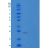 人t细胞受体相互作用分子/TRIM/TCRIM/TRAT1重组蛋白C-6His